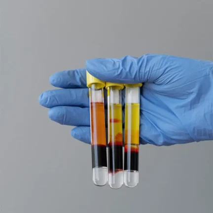 PRP-injections