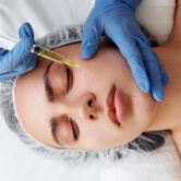 Vampire Facial