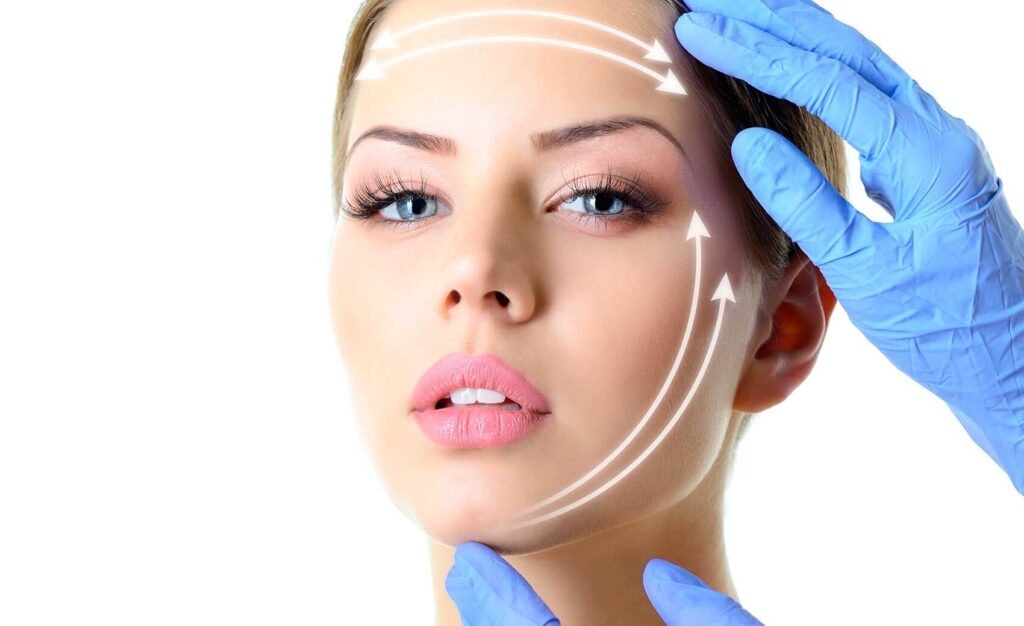 facelift