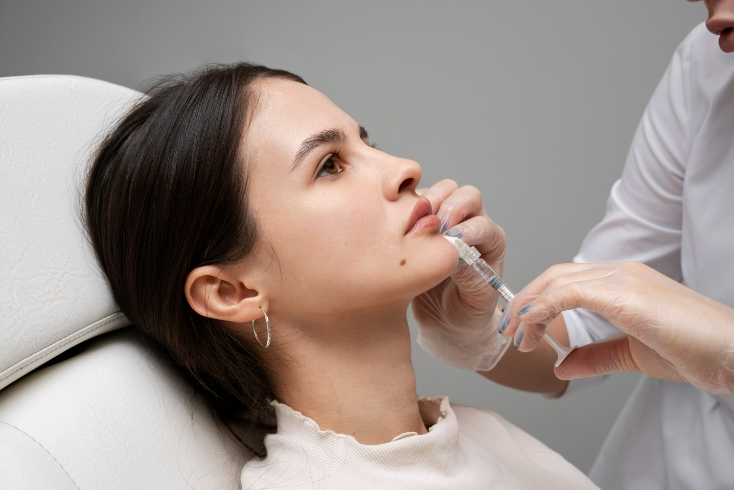Lip Fillers